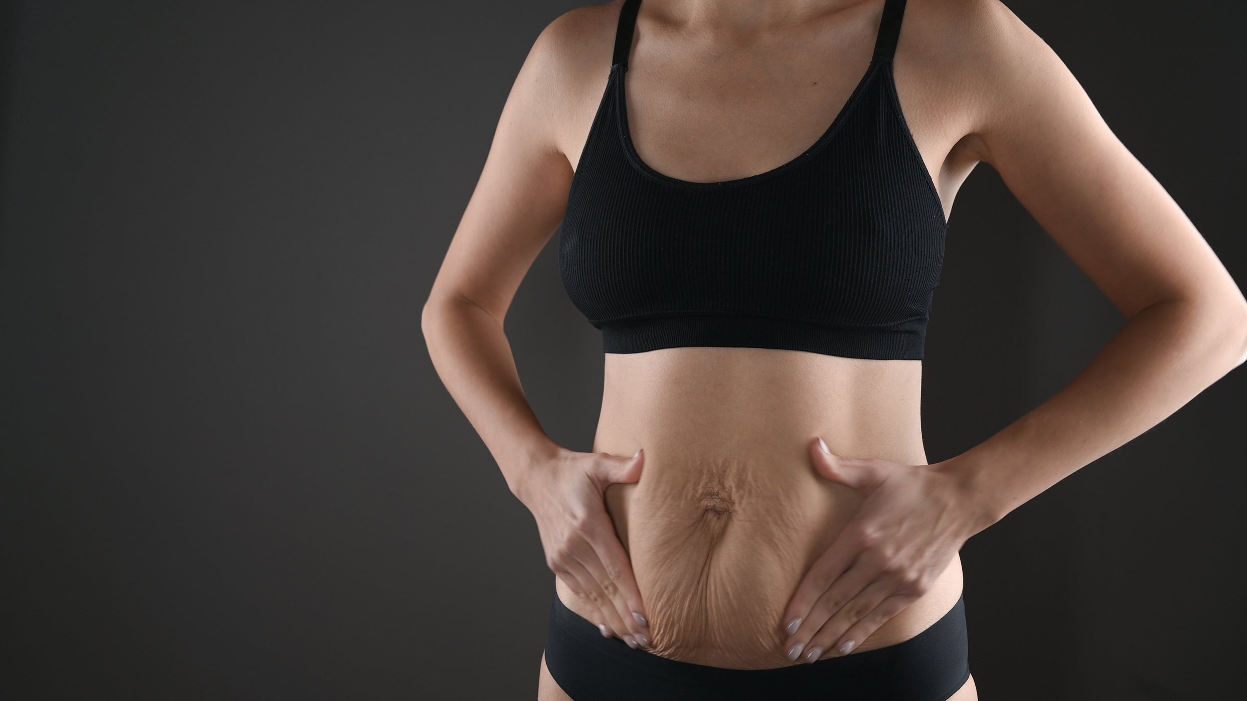 A woman with excess skin. Does skin removal surgery leave scars? Yes — but placement, healing, and aftercare make all the difference. Here's what to realistically expect.