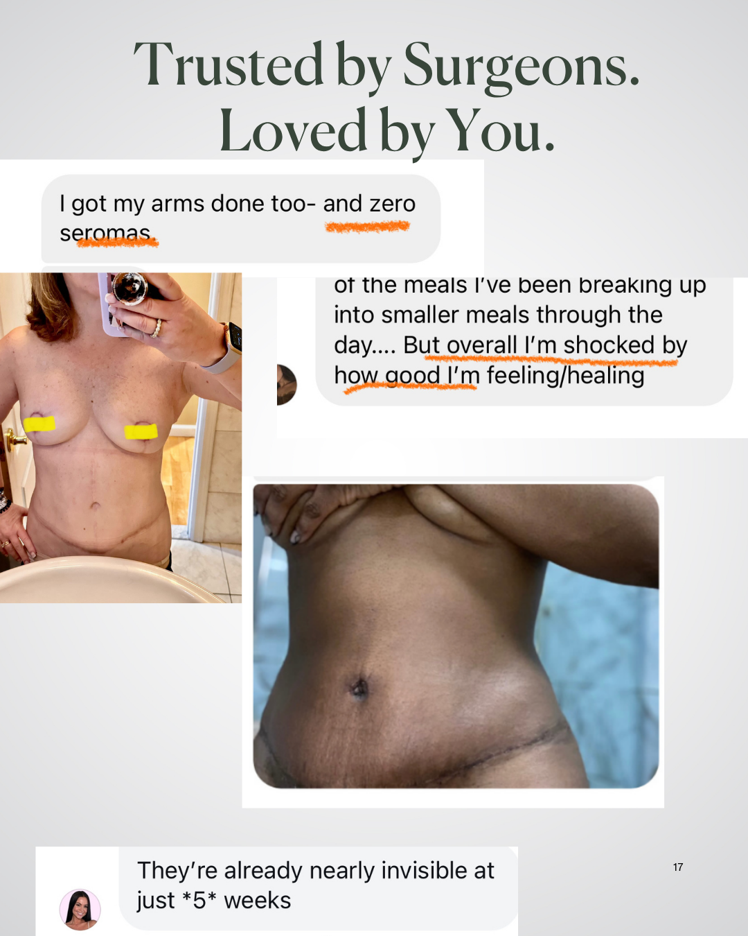 A collage shows a woman’s torso five weeks after surgery with minimal seromas, rapid incision healing, and barely visible scars. Text: Before + After Vitals - NutriSurgical Vitamin Powder. Trusted by Surgeons. Loved by You.